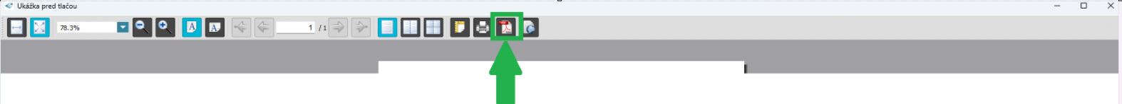 Prehľady - Fondy - stav fondov